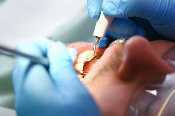Best Tooth Infection Emergency Dentist  in Lawrence, NY